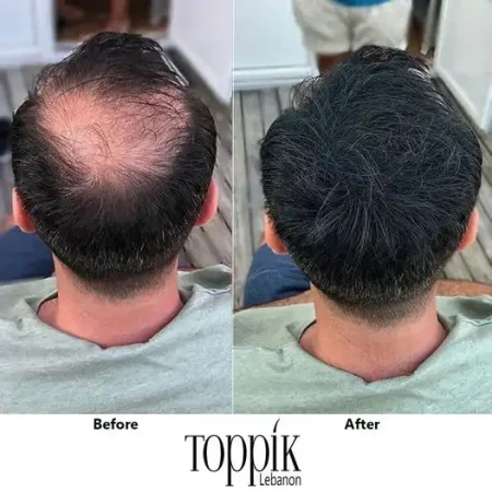 بودر Toppik Hair Fibers لملئ فراغات الشعر في 30 ثانية