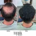 بودر Toppik Hair Fibers لملئ فراغات الشعر في 30 ثانية